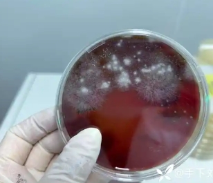 其他微生物检测